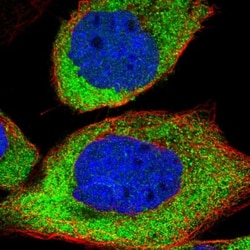 Integrin alpha 6/CD49f Antibody, Novus Biologicals:Antibodies:Primary Antibodies